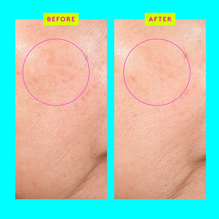 Bouncy Brightfacial™ - GLAM MODA