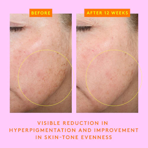 C-Firma Fresh Vitamin-C Day Serum - GLAM MODA