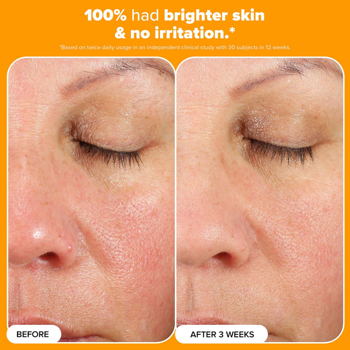 C15 Super Booster 20ml - GLAM MODA