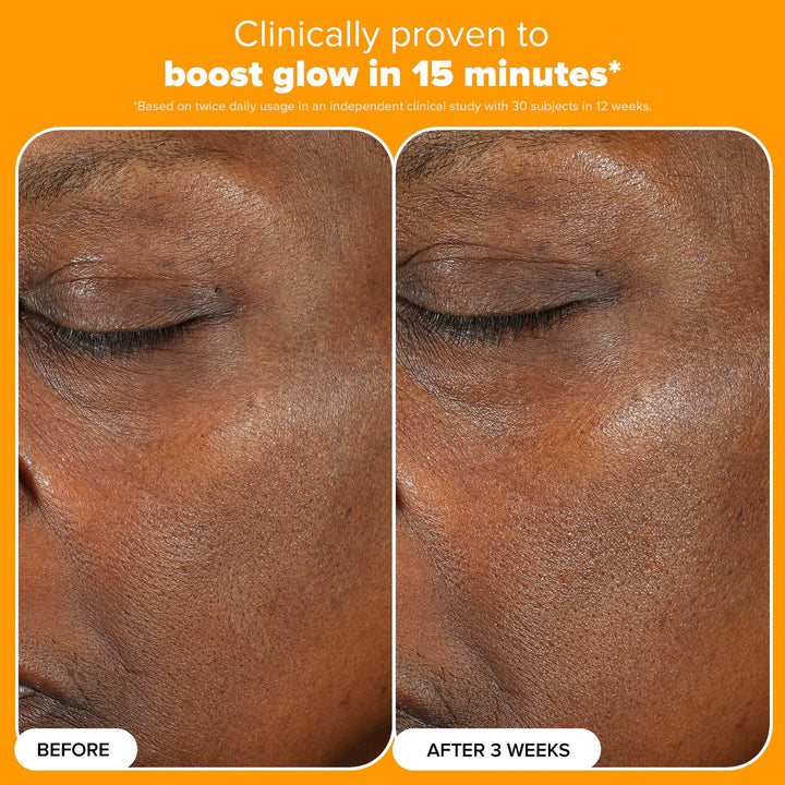 C15 Super Booster 20ml - GLAM MODA