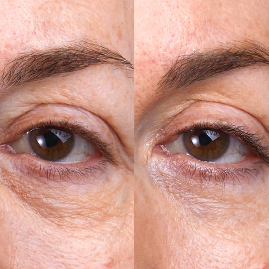 C5 Super Boost Eye Cream 15ml - GLAM MODA