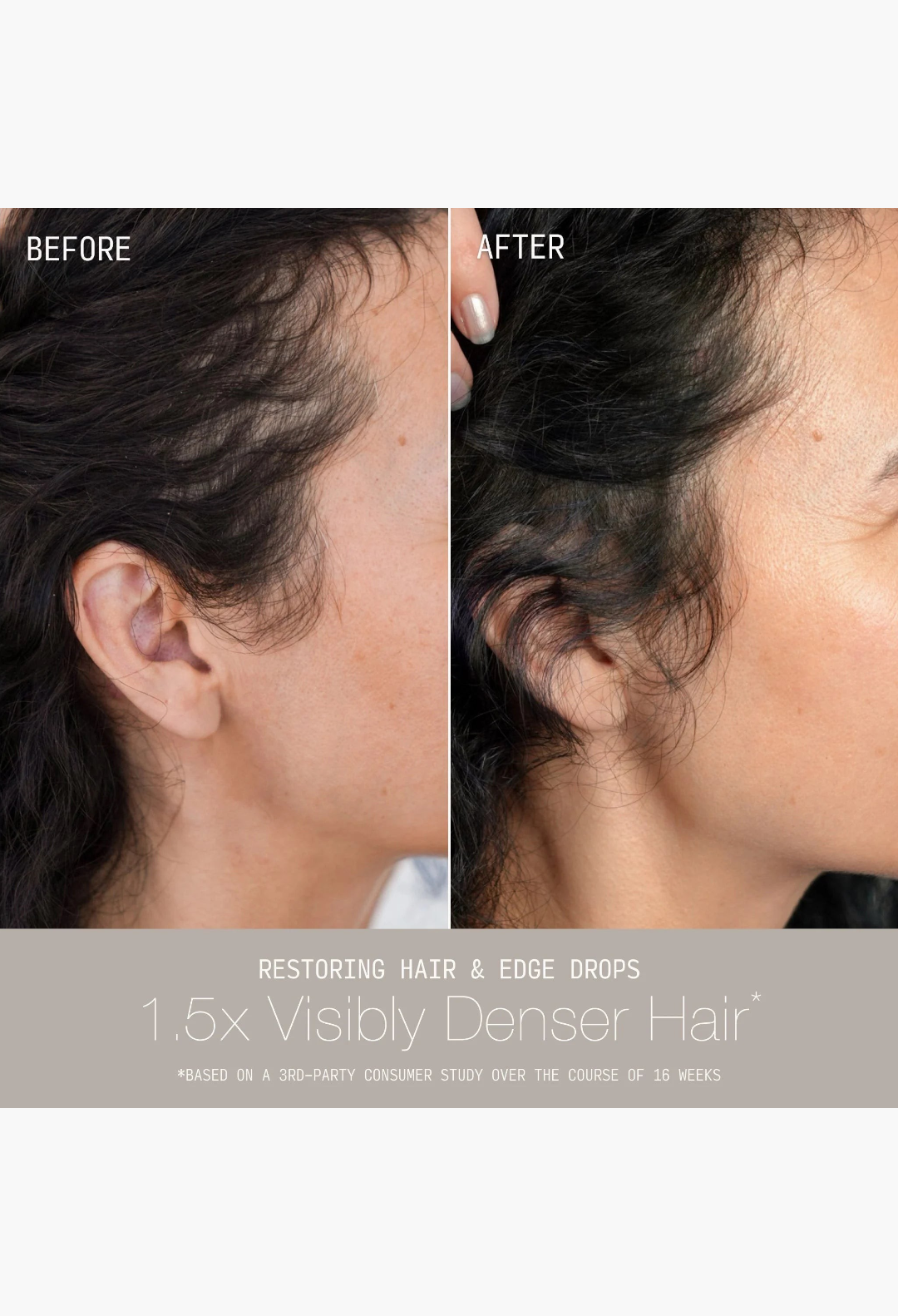 GLAM MODA before and after comparison showing improved hair density and fuller edges after using hair serum