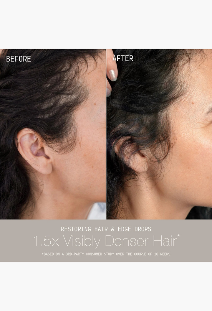 GLAM MODA before and after comparison showing improved hair density and fuller edges after using hair serum