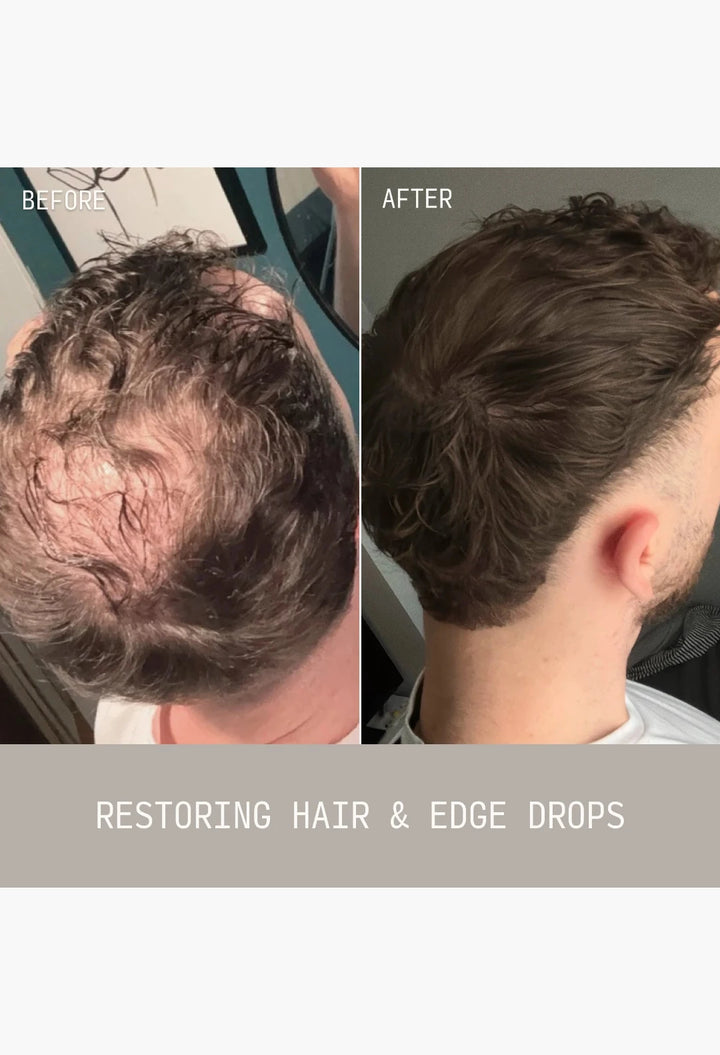 Restoring Hair & Edge Drops