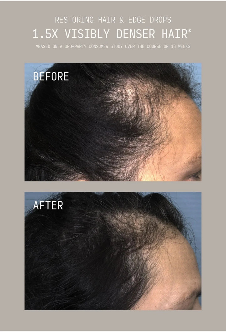 Restoring Hair & Edge Drops