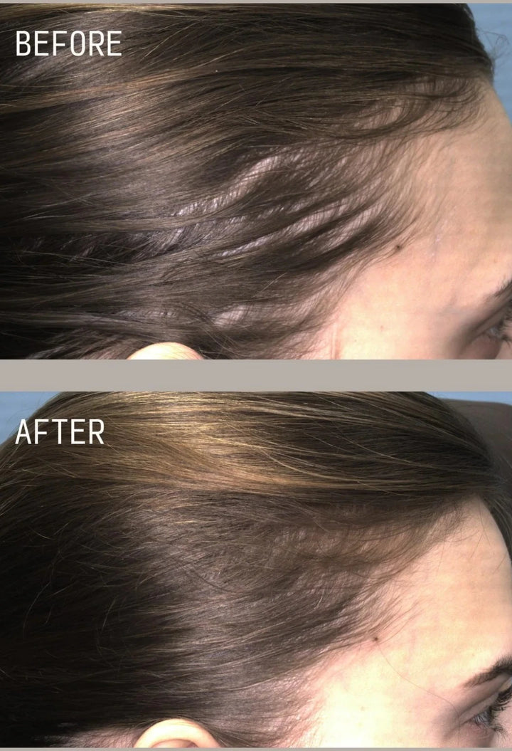 Restoring Hair & Edge Drops