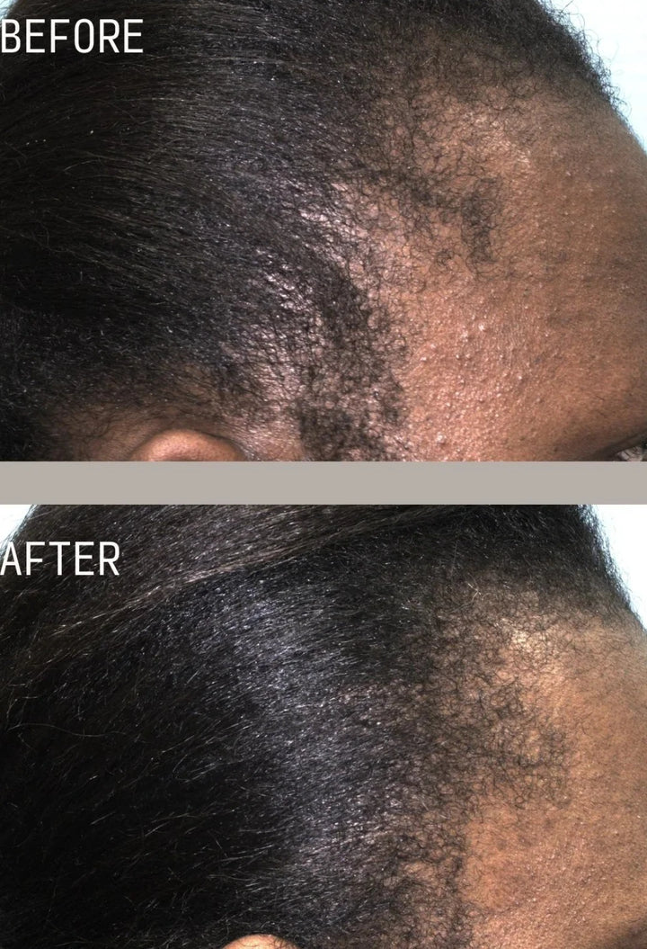Restoring Hair & Edge Drops