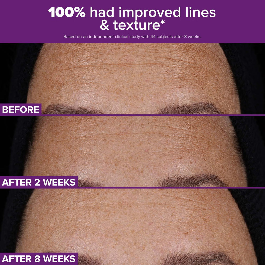 Clinical Pro Retinaldehyde Dual-Retinoid Treatment 30ml - GLAM MODA