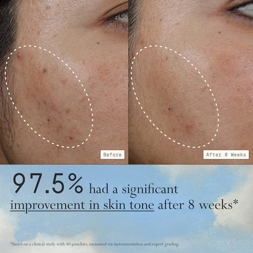 Deliverance 3-in-1 Repair Serum for Redness, Wrinkles, Dark Spots - GLAM MODA