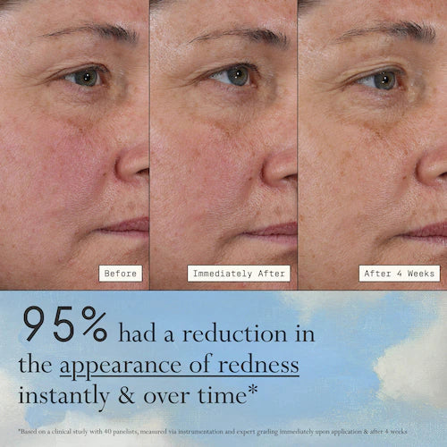 Deliverance 3-in-1 Repair Serum for Redness, Wrinkles, Dark Spots - GLAM MODA