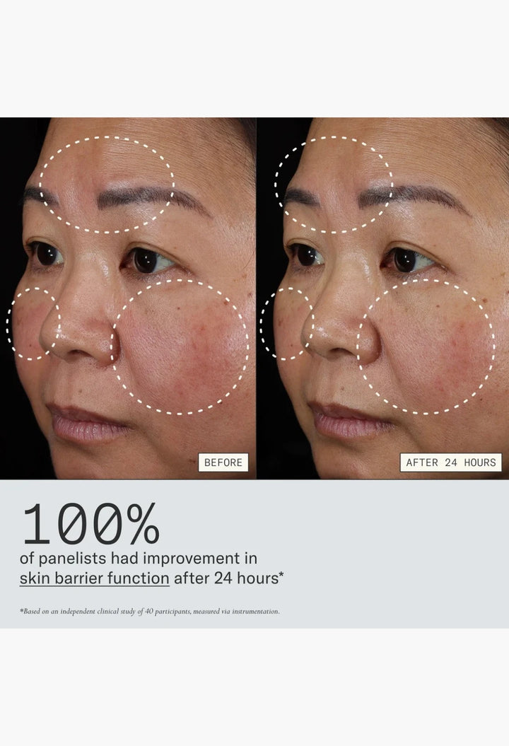 Instant Angel Lipid-Rich Firming Moisturizer