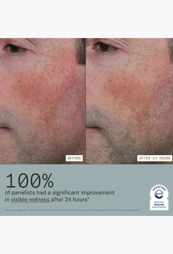 Skin Mercy Intense Recovery Cream for Sensitive & Eczema-Prone Skin