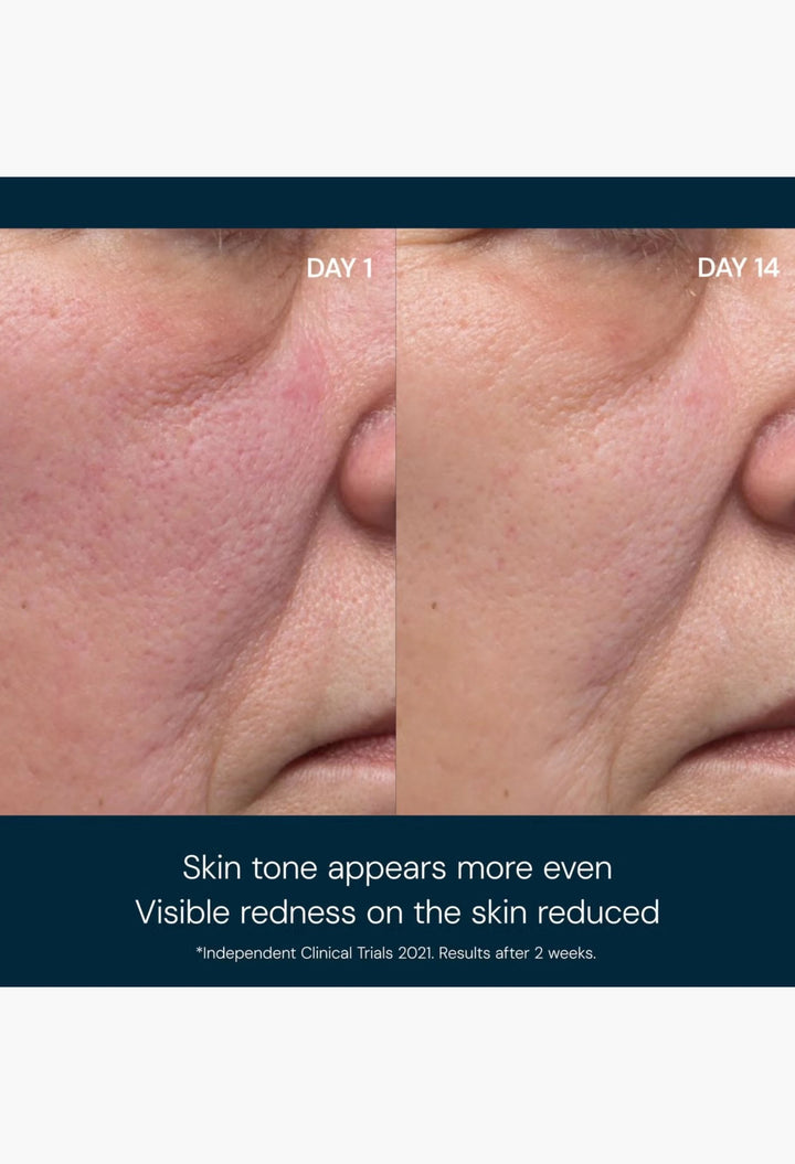 Elemis Dynamic Resurfacing Facial Pads