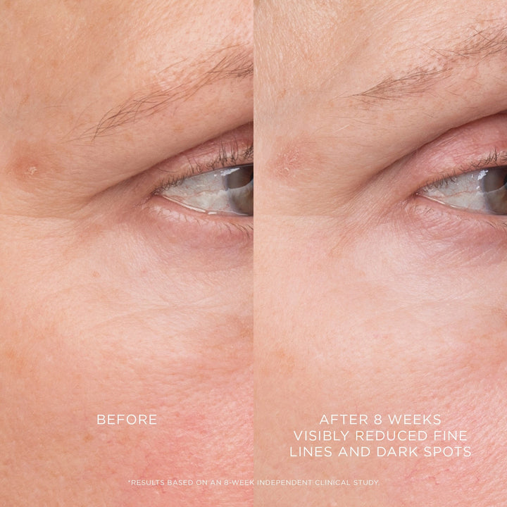 Equilibrium Resurfacing Retinoid Treatment - GLAM MODA