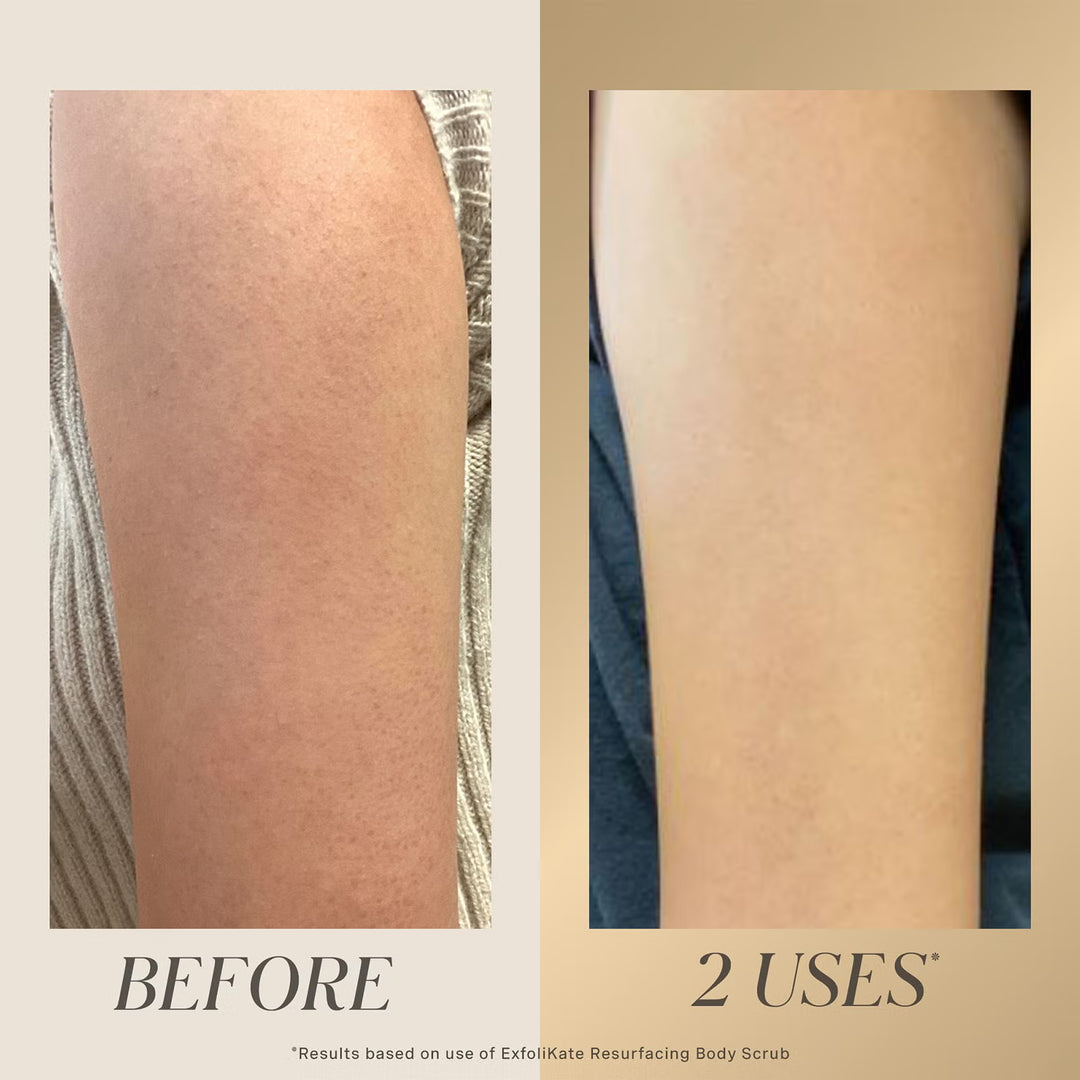 Exfolikate Resurfacing Body Scrub 150ml - GLAM MODA