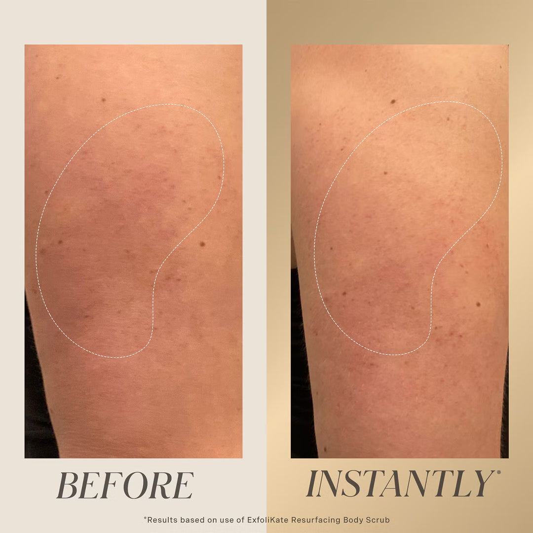 Exfolikate Resurfacing Body Scrub 150ml - GLAM MODA