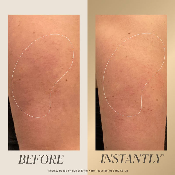 Exfolikate Resurfacing Body Scrub 150ml - GLAM MODA