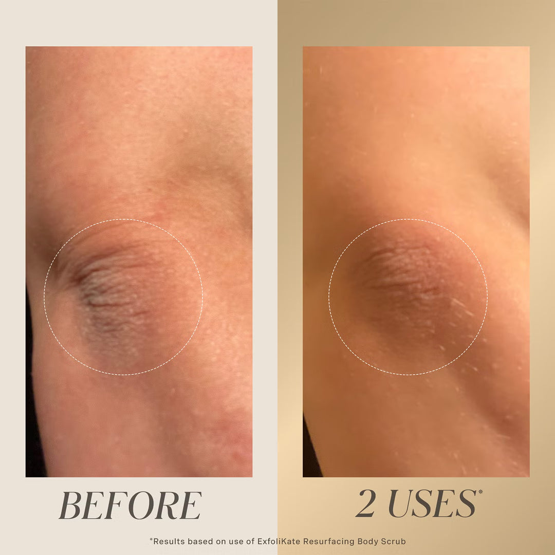 Exfolikate Resurfacing Body Scrub 150ml - GLAM MODA