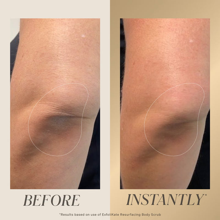 Exfolikate Resurfacing Body Scrub 150ml - GLAM MODA