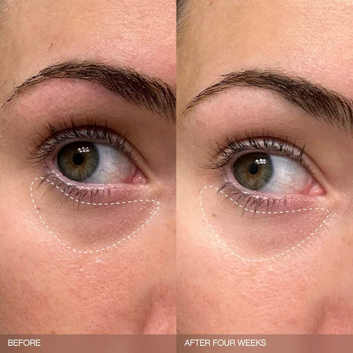 Faded Brightening Bundle for Discoloration on Face & Body (UNSCENTED) - GLAM MODA