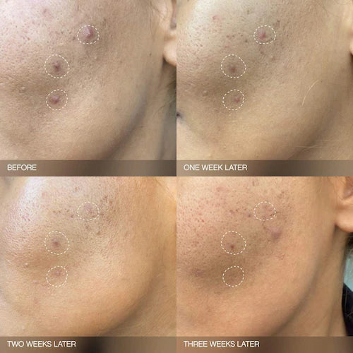 Faded Brightening Bundle for Discoloration on Face & Body (UNSCENTED) - GLAM MODA