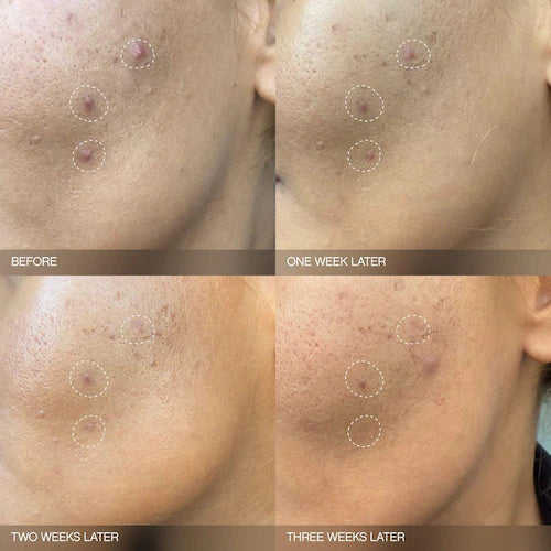 Faded Brightening Serum for Dark Spots and Discoloration (UNSCENTED) - GLAM MODA