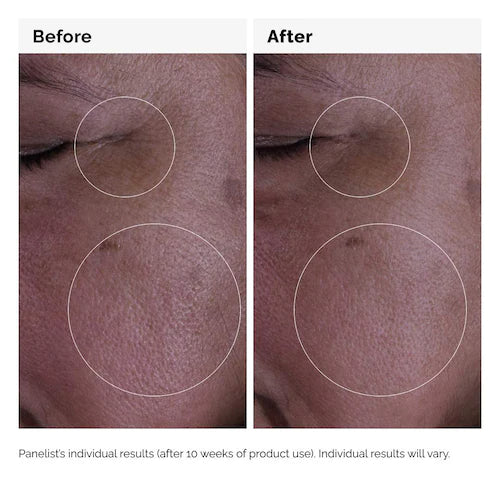 GF 15% Serum for Visible Skin Repair and Wrinkles - GLAM MODA