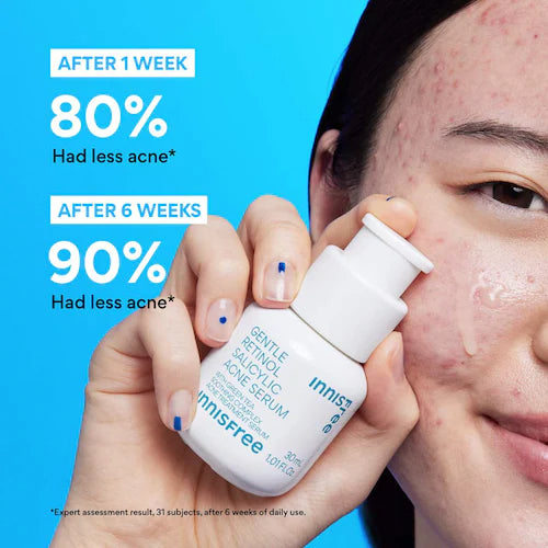 Gentle Retinol Salicylic Acne Serum - GLAM MODA