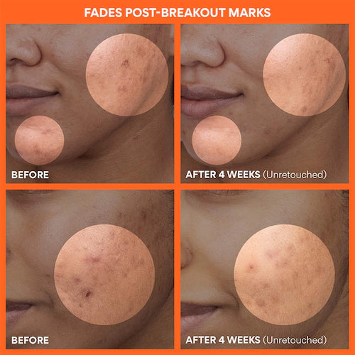 Green Tea Enzyme Vitamin C Brightening + Exfoliating Toner Pads - GLAM MODA