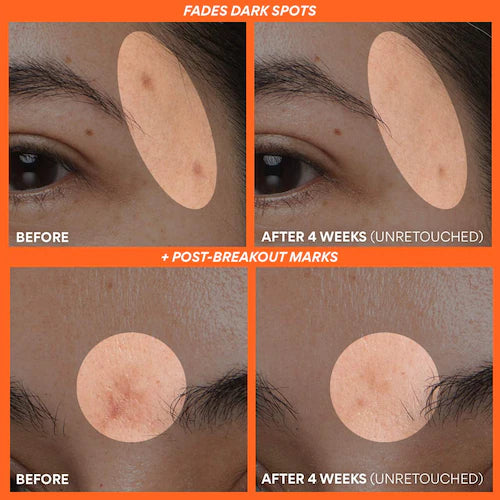 Green Tea Enzyme Vitamin C Brightening Serum - GLAM MODA