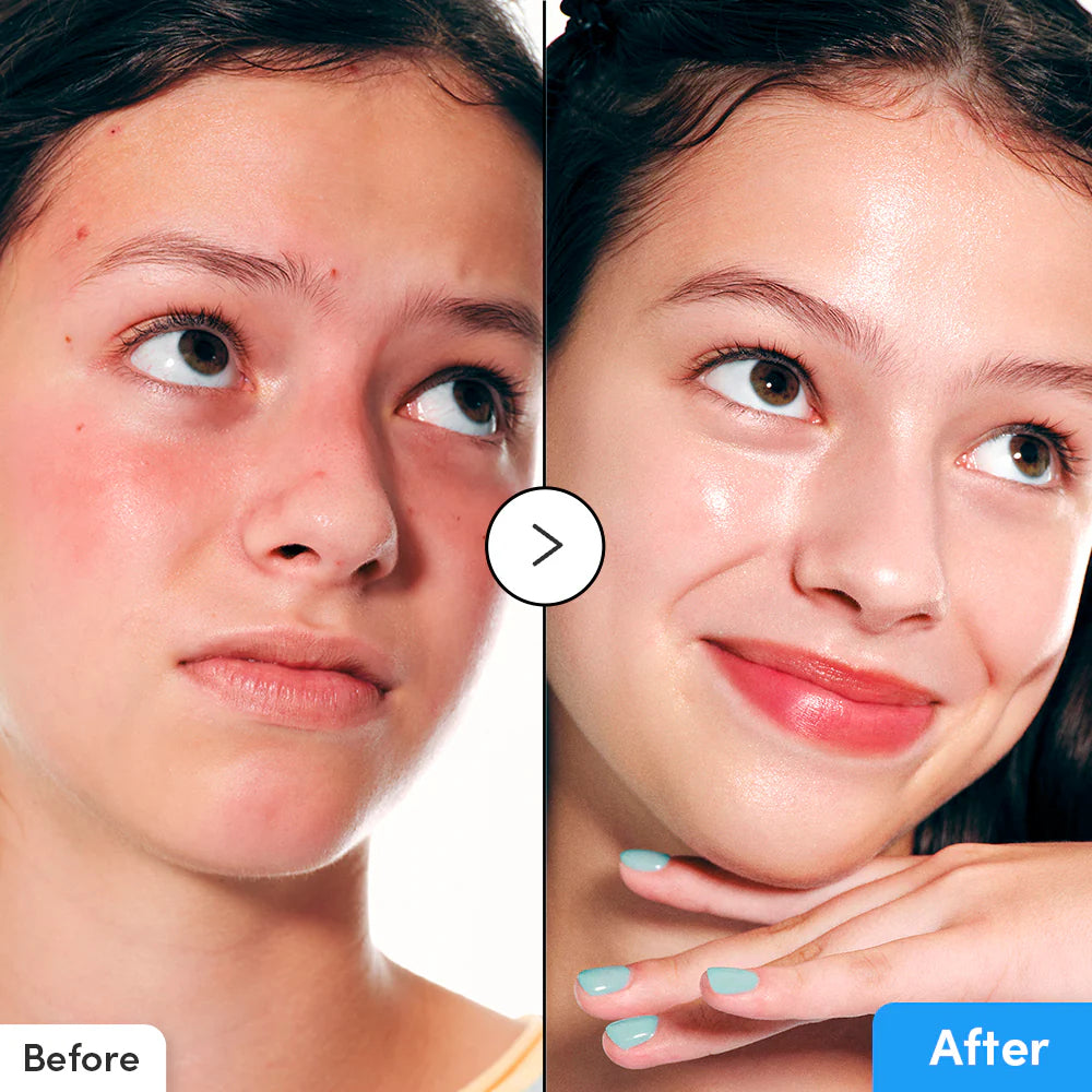 Hyaltoin Flooding Serum - GLAM MODA