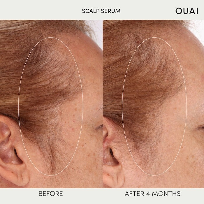 Hydrating Scalp Serum for Healthy, Fuller Looking Hair - GLAM MODA