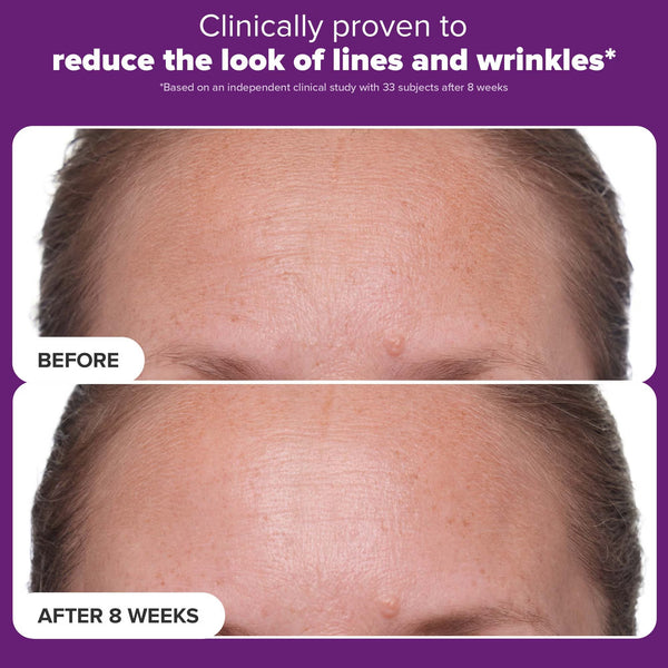 Clinical 1% Retinol Treatment