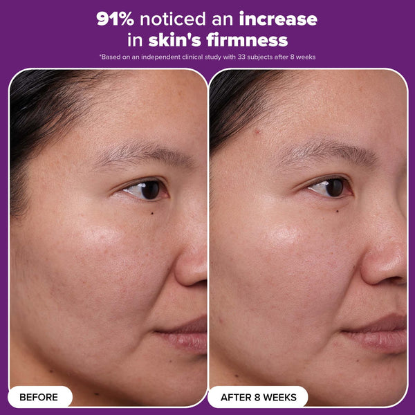 Clinical 1% Retinol Treatment
