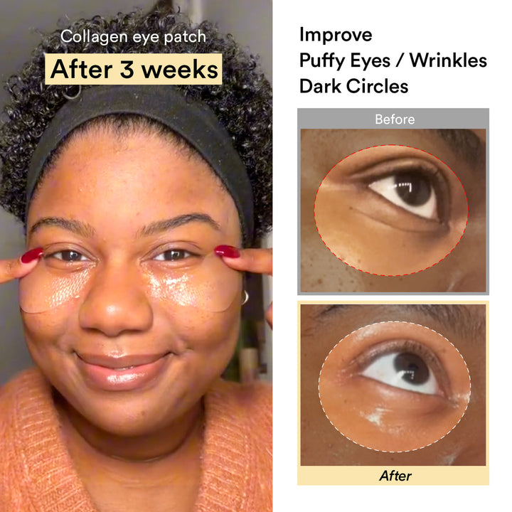 Collagen Eye Patch Jericho Rose Jelly - GLAM MODA