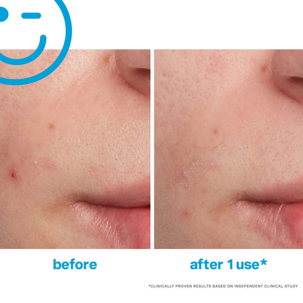 EradiKate Blemish Treatment 30ml