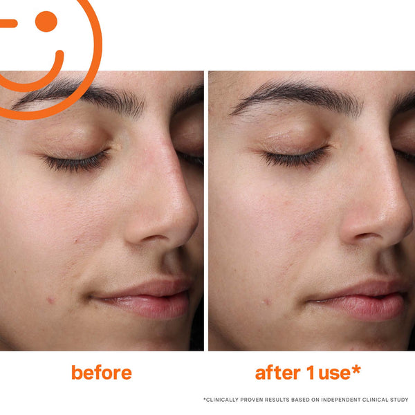 ExfoliKate Cleanser Daily Foaming Wash