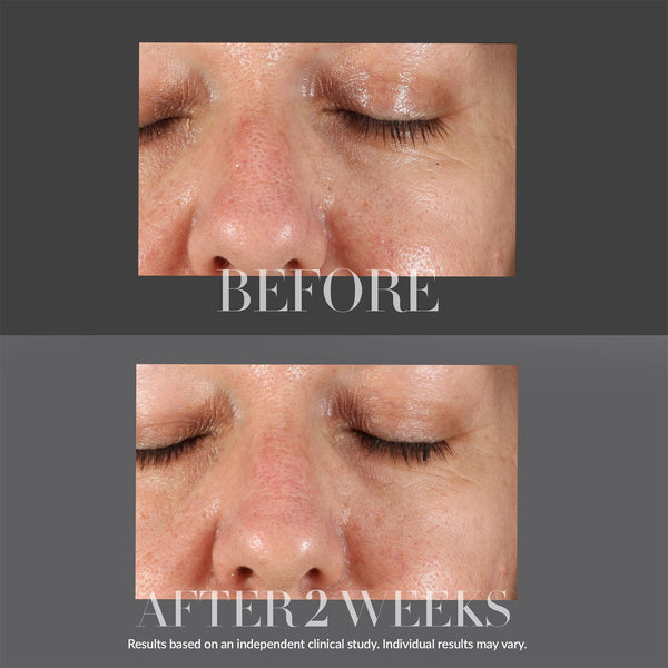 KateCeuticals Resurfacing Overnight Peel 30ml
