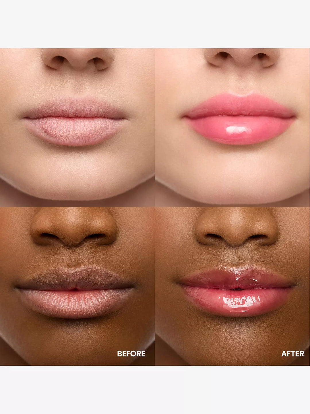 Lip Rehab Serum Oil 3.57ml - GLAM MODA