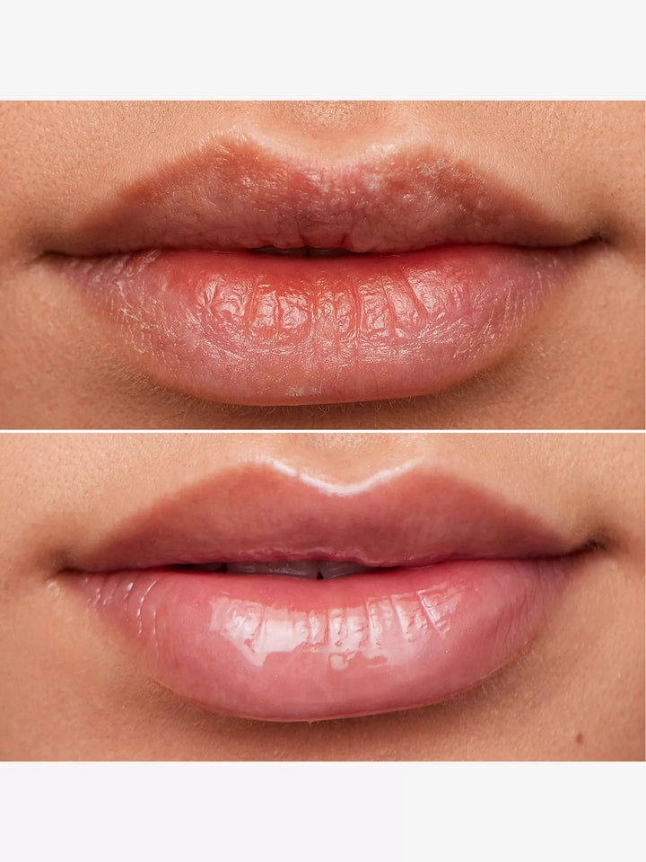 Lip Rehab Serum Oil 3.57ml - GLAM MODA