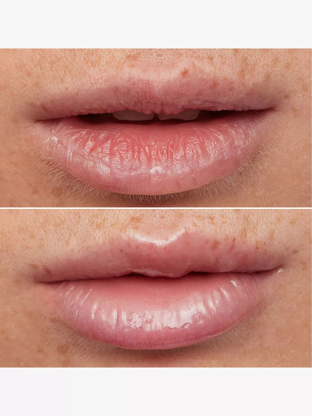 Lip Rehab Serum Oil 3.57ml - GLAM MODA