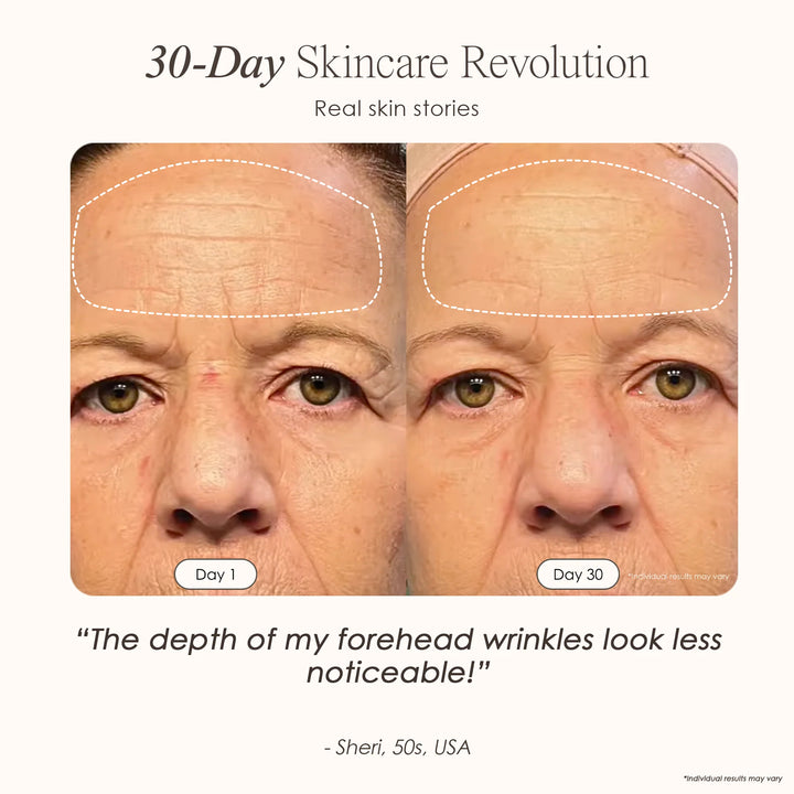 LumaLux Face | Pro LED Red Light Therapy Mask - GLAM MODA