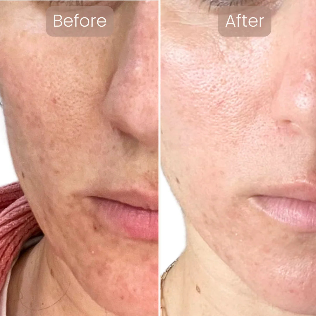 Lumnae™ Advanced LED Light Therapy Mask - GLAM MODA