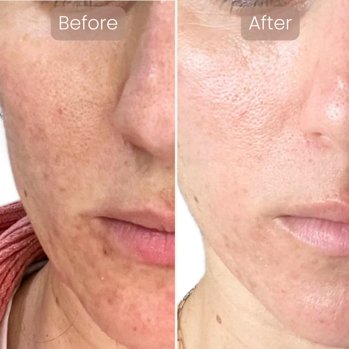 Lumnae™ Advanced LED Light Therapy Mask - GLAM MODA