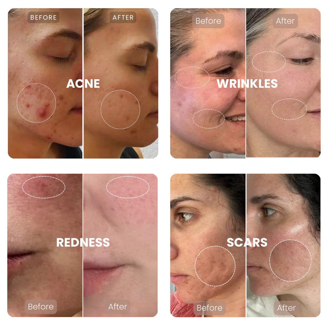 Lumnae™ Advanced LED Light Therapy Mask - GLAM MODA