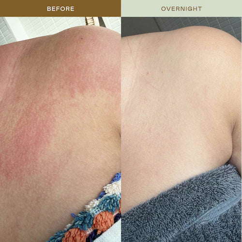 Mami Wata Barrier Strengthening Face Mist with Cica, Panthenol, Ectoin for Sensitive, Irritated Skin - GLAM MODA