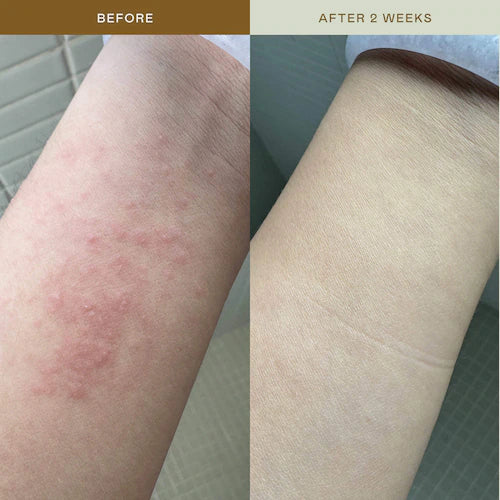 Mami Wata Barrier Strengthening Face Mist with Cica, Panthenol, Ectoin for Sensitive, Irritated Skin - GLAM MODA