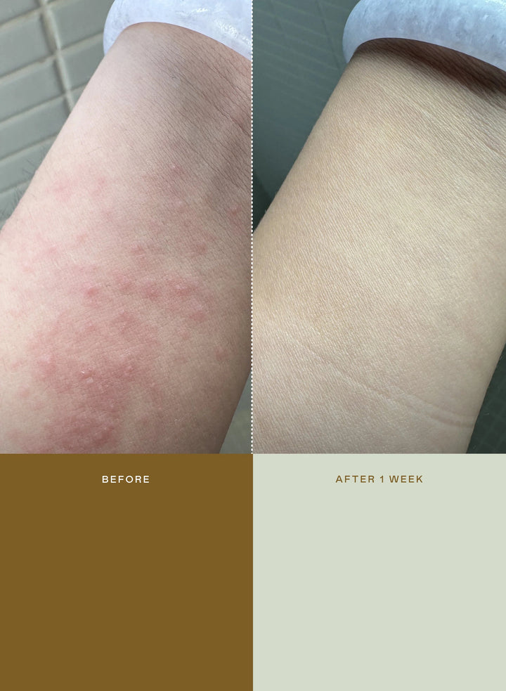 Mami Wataultra-Calming Rescuemist - GLAM MODA