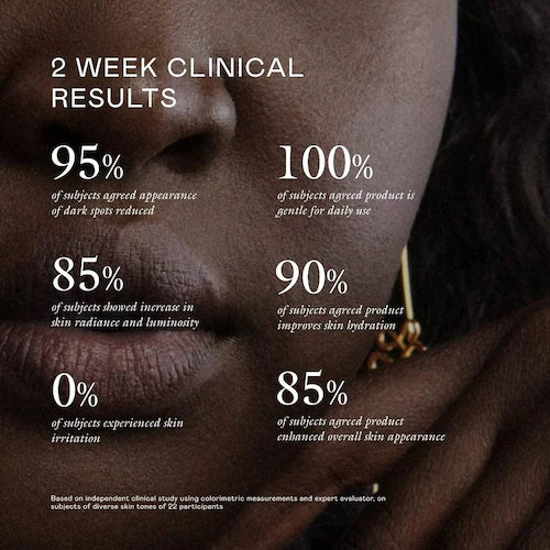 Milk Marvel Dark Spot Serum with Niacinamide and Vitamin C - GLAM MODA