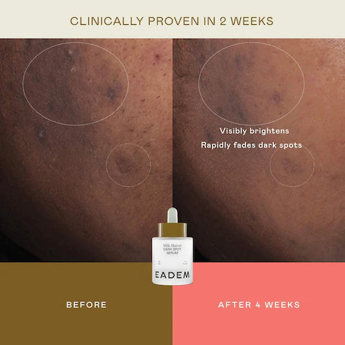 Milk Marvel Dark Spot Serum with Niacinamide and Vitamin C - GLAM MODA